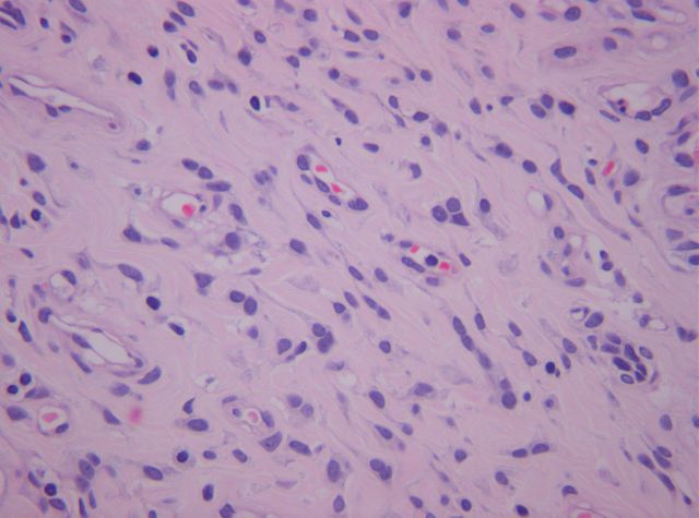 Hematoxilina-Eosina x400 - <div style=